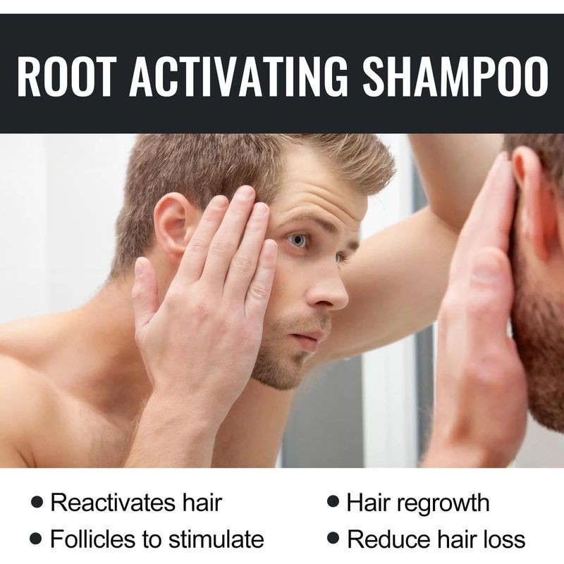 Shampoo Anticaída Activador de Raíces YUUCANGH 66207777-2PCS 100ml