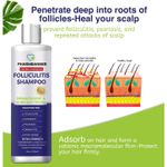 Shampoo Antifúngico Pharmbanner Foliculitis 250ml